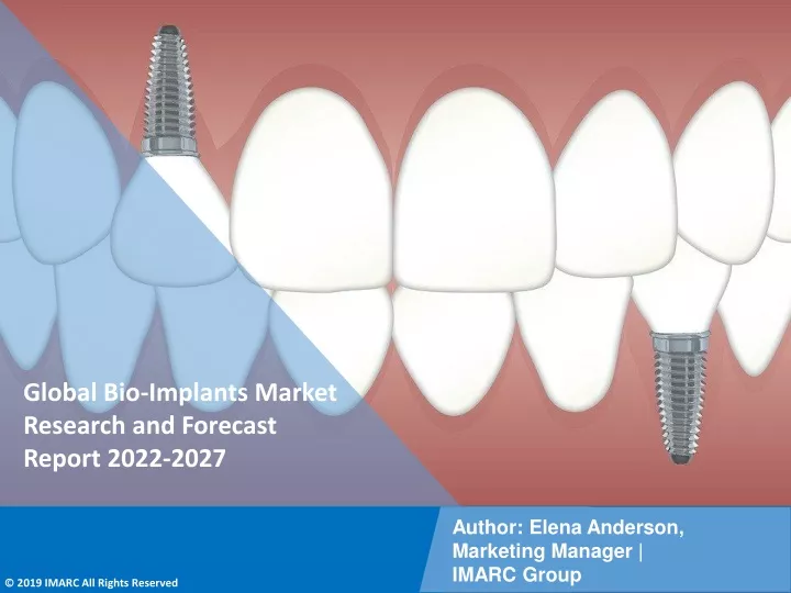 global bio implants market research and forecast