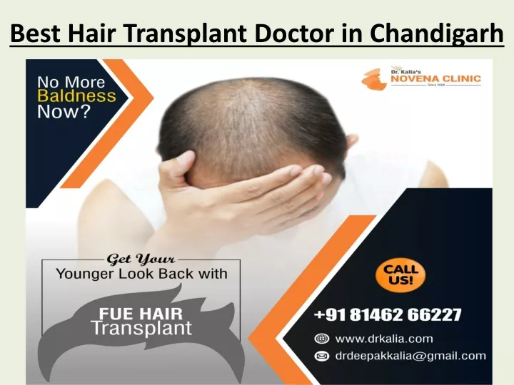 best hair t ransplant d octor in chandigarh