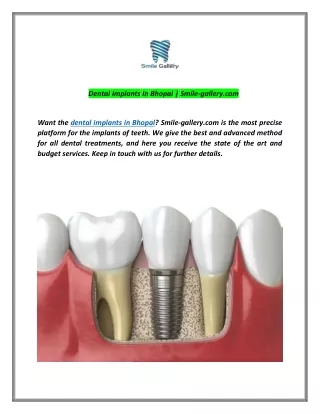 dental implants in bhopal smile gallery com