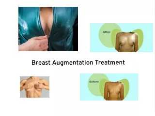 Breast Augmentation Treatment