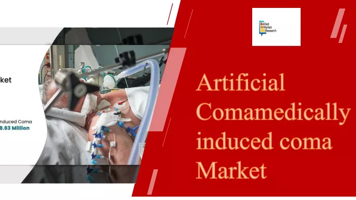 artificial comamedically induced coma market
