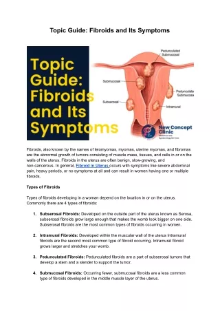 topic guide fibroids and its symptoms