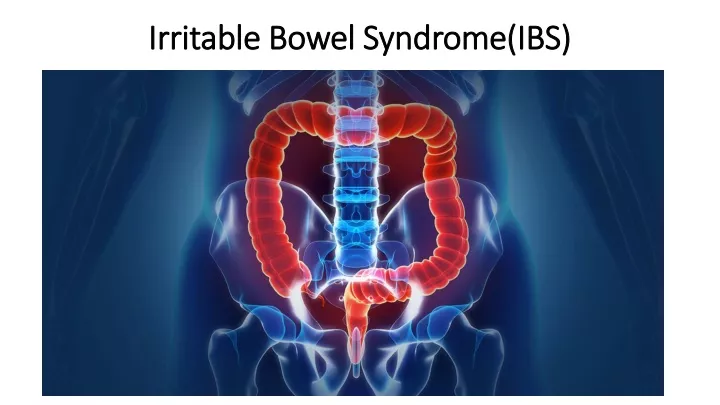 irritable bowel syndrome ibs