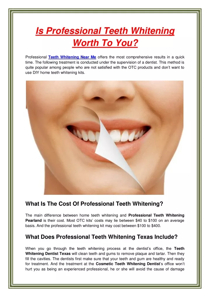 is professional teeth whitening worth to you