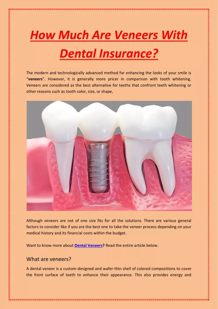 how much are veneers with dental insurance