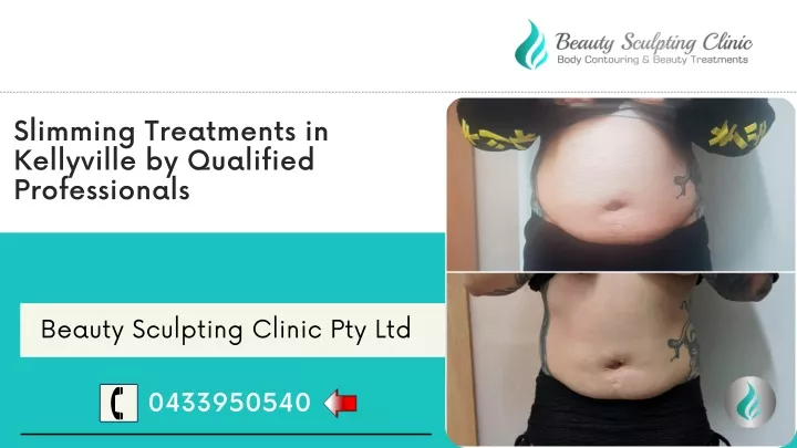 slimming treatments in kellyville by qualified