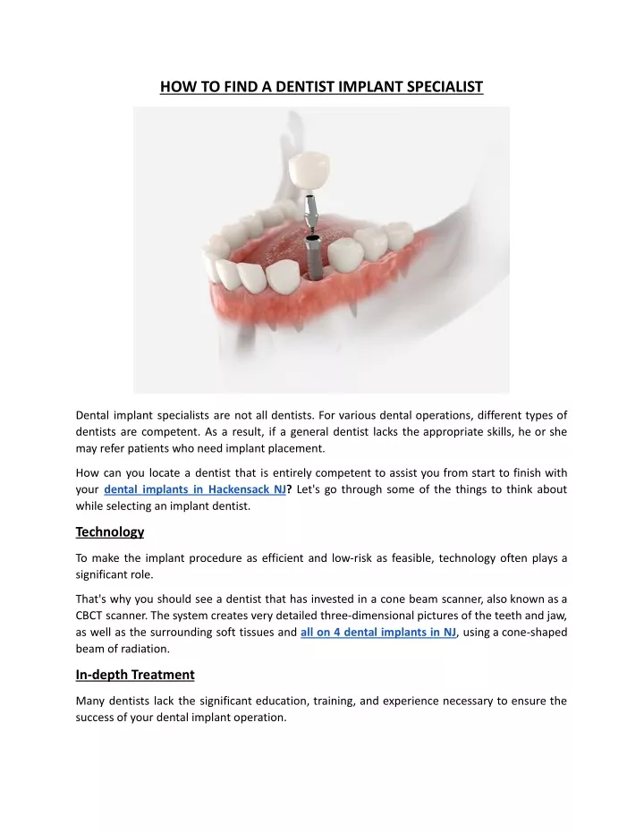 how to find a dentist implant specialist