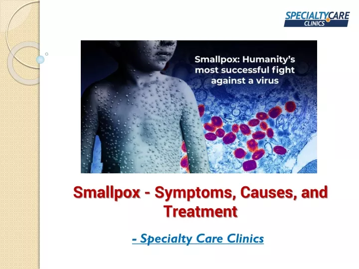smallpox symptoms causes and treatment