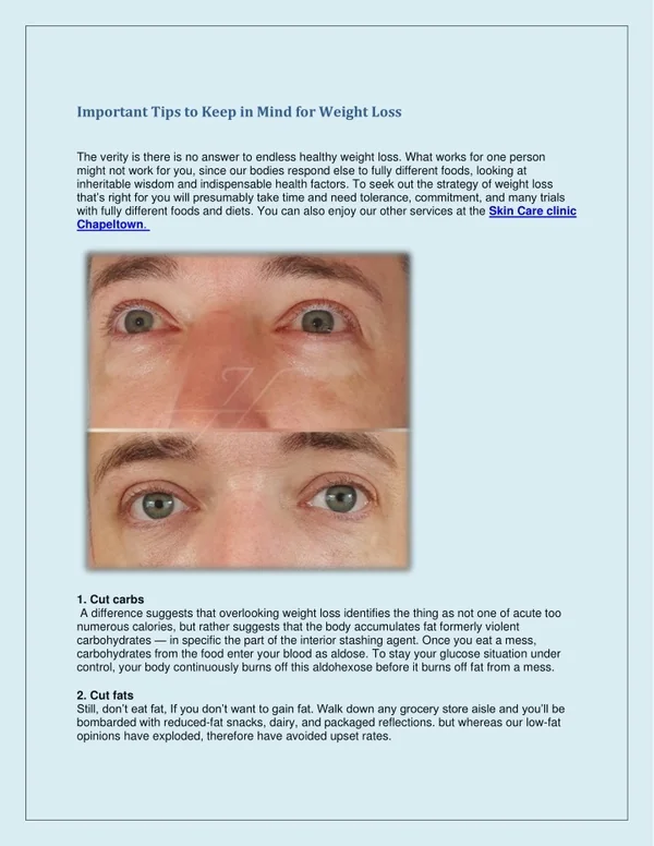 The best Skin Care clinic in Chapeltown
