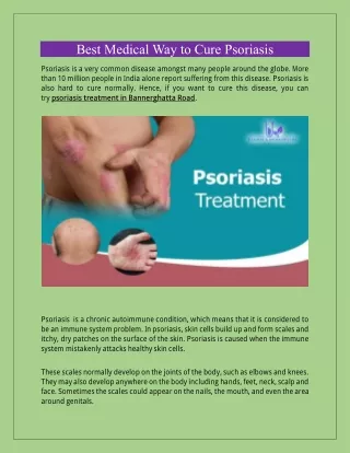 best medical way to cure psoriasis