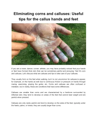 Eliminating corns and calluses_ Useful tips for the callus hands and feet