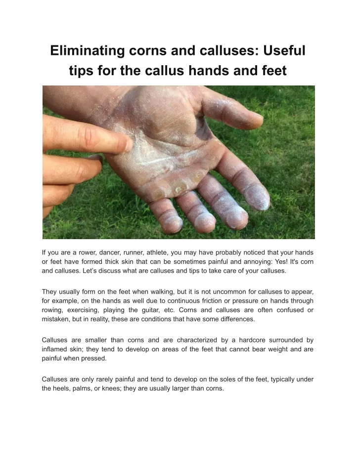 eliminating corns and calluses useful tips