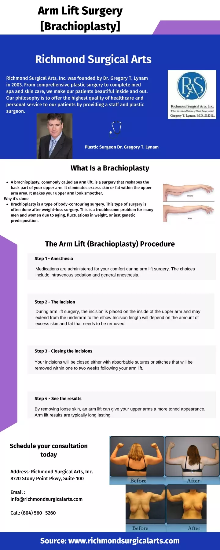 arm lift surgery brachioplasty