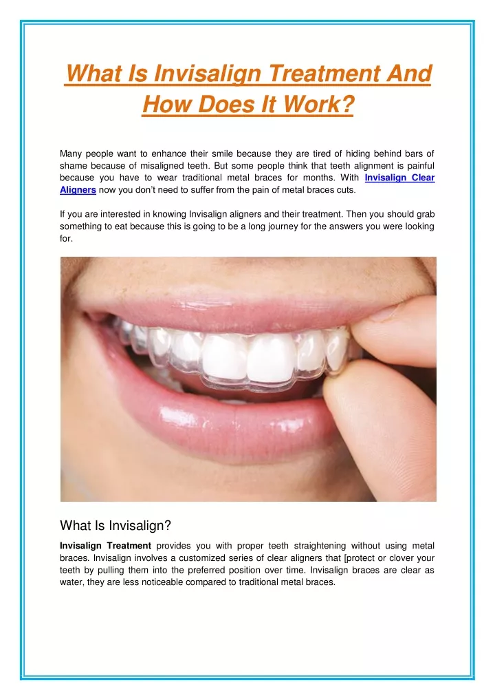 what is invisalign treatment and how does it work