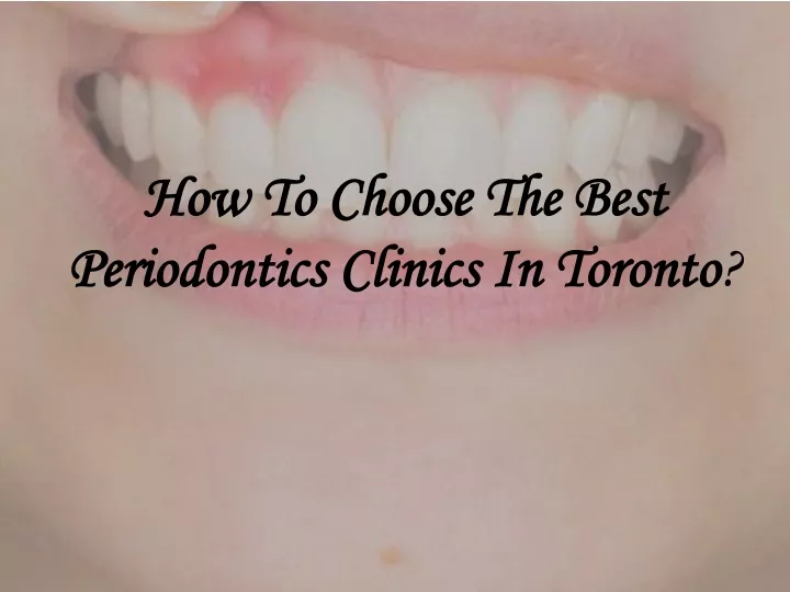 how to choose the best periodontics clinics in toronto