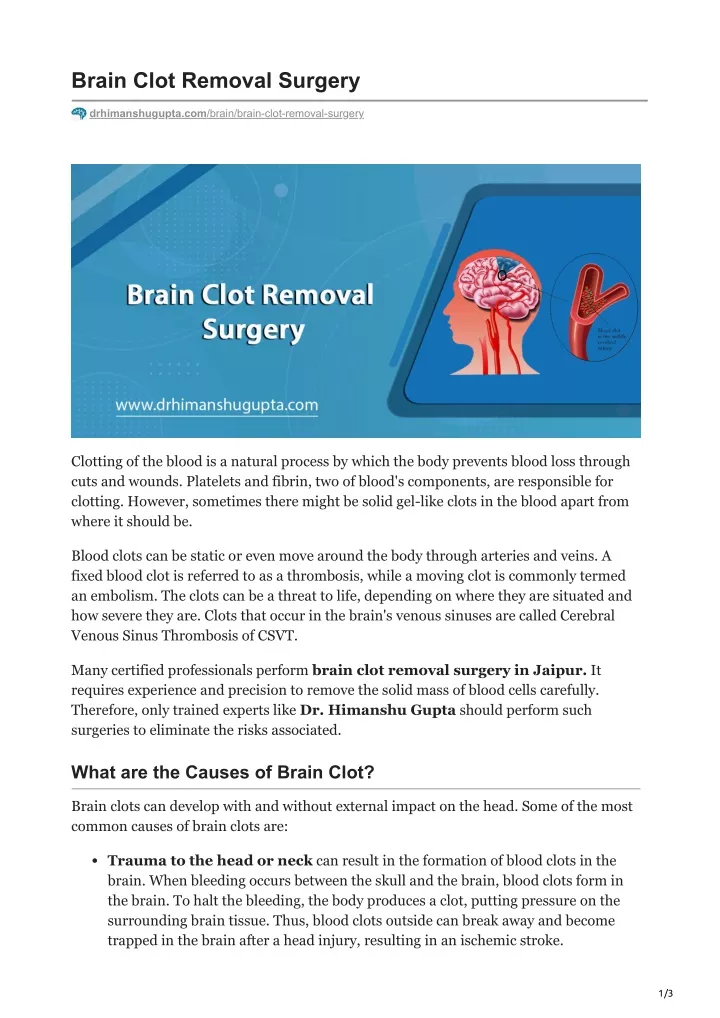 brain clot removal surgery