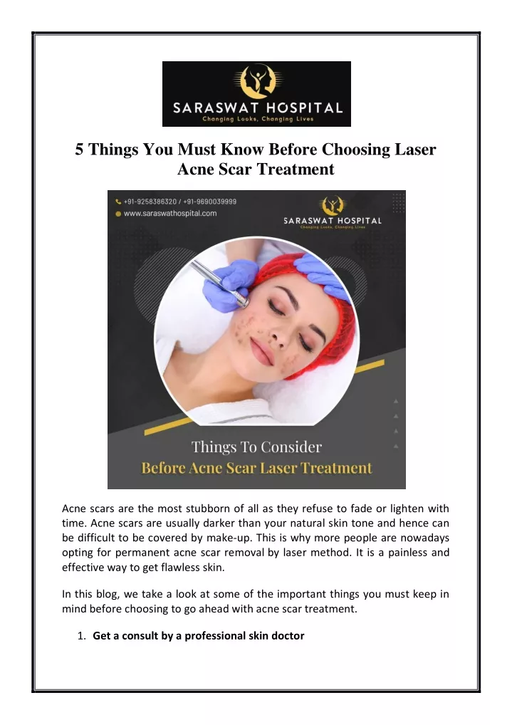 5 things you must know before choosing laser acne