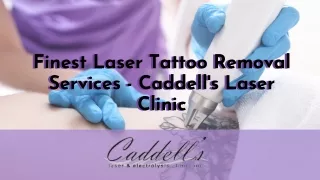 Finest Laser Tattoo Removal Services - Caddell's Laser Clinic