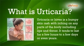 Urticaria Homeopathic Medicine