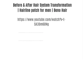 Before & After Hair System Transformation | Hairline patch for men | Bono Hair