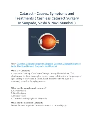 Cashless Cataract Surgery In Sanpada, Vashi and Navi Mumbai - Advancedeyehospital