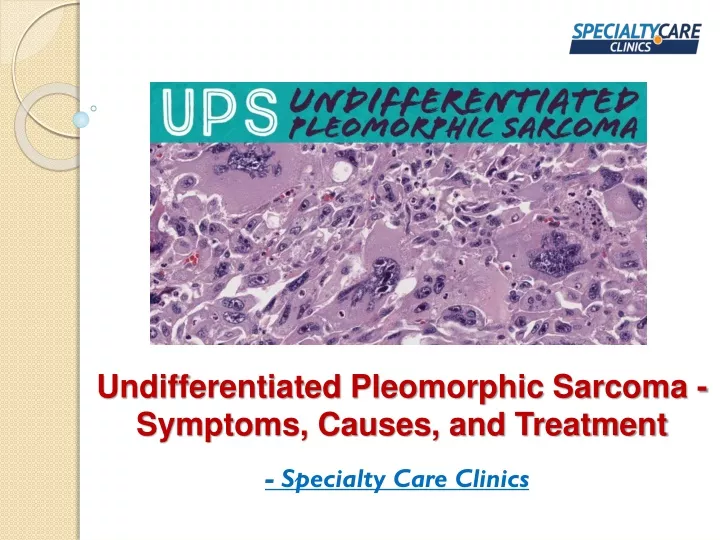 undifferentiated pleomorphic sarcoma symptoms causes and treatment