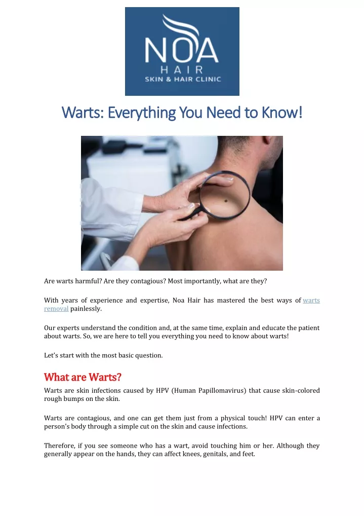 warts everything you need to know warts