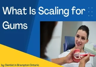 What Is Scaling for Gums by Dentist in Brampton Ontario
