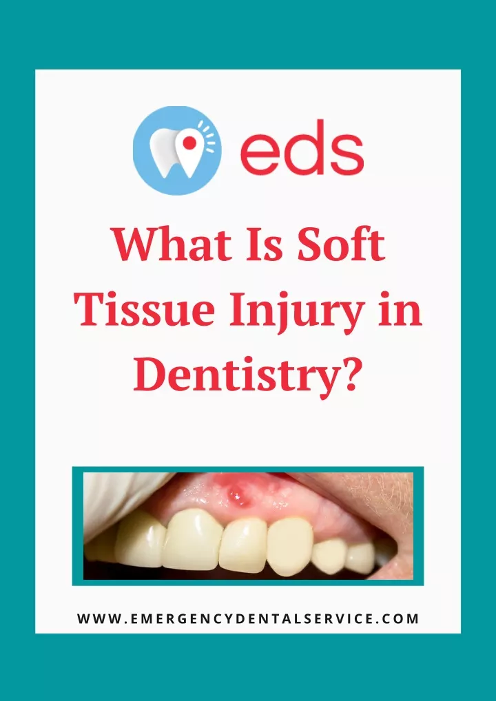 what is soft tissue injury in dentistry