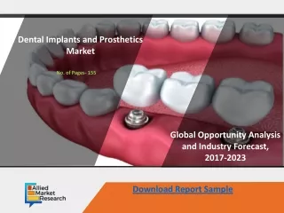 Dental Implants and Prosthetics Market COMPETITIVE SITUATION AND TRENDS BY 2030