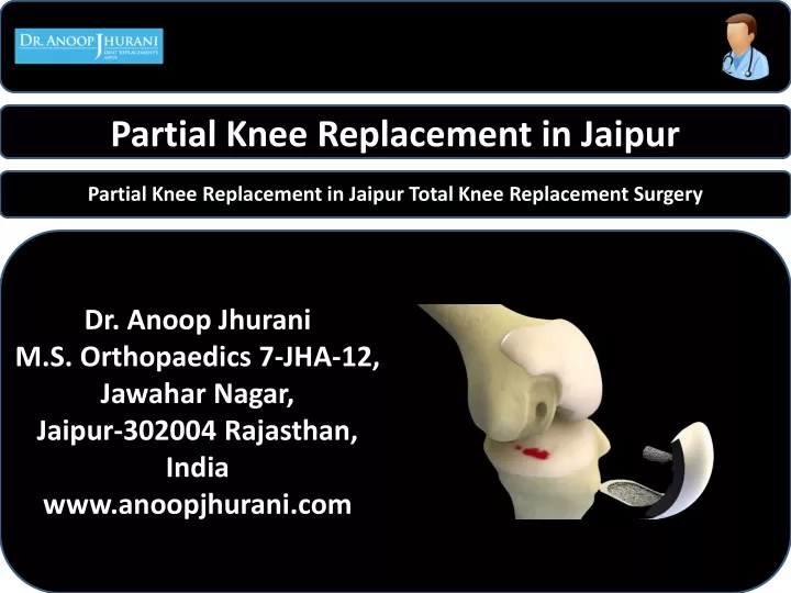partial knee replacement in jaipur