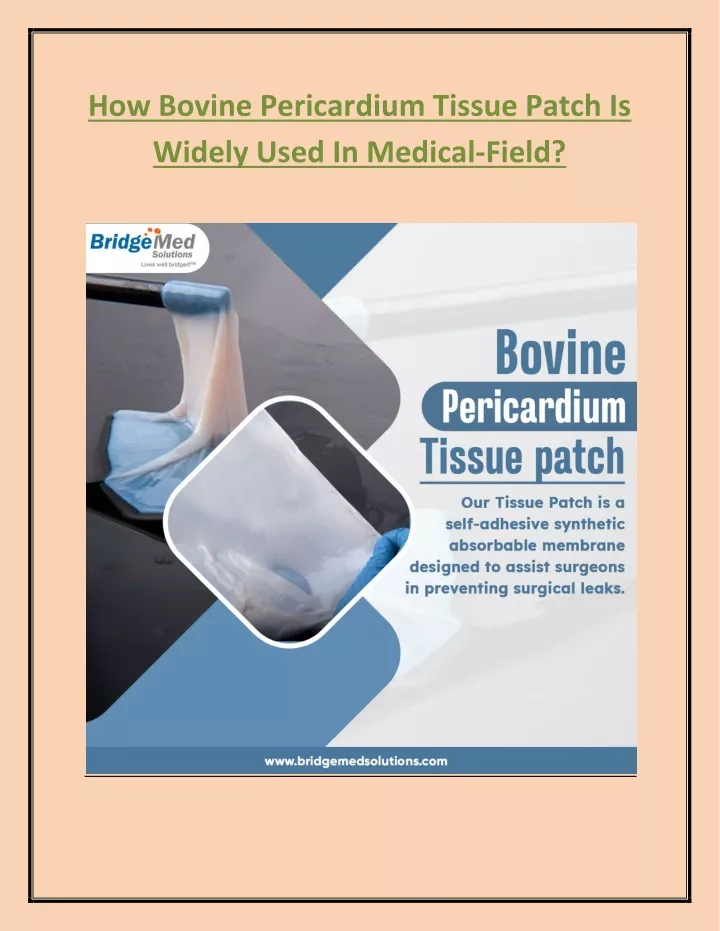 how bovine pericardium tissue patch is widely