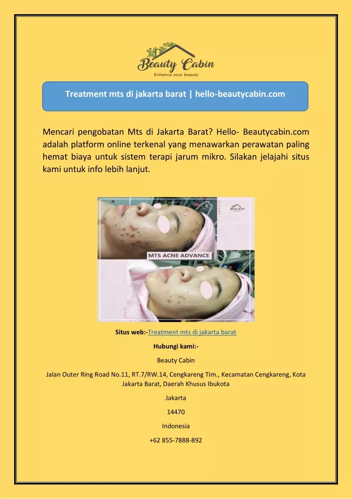 treatment mts di jakarta barat hello beautycabin