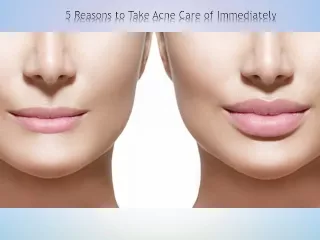 5 Reasons to Take Acne Care of Immediately
