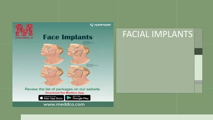 facial implants