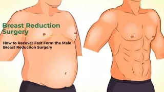How to Recover Fast Form the Male Breast Reduction Surgery