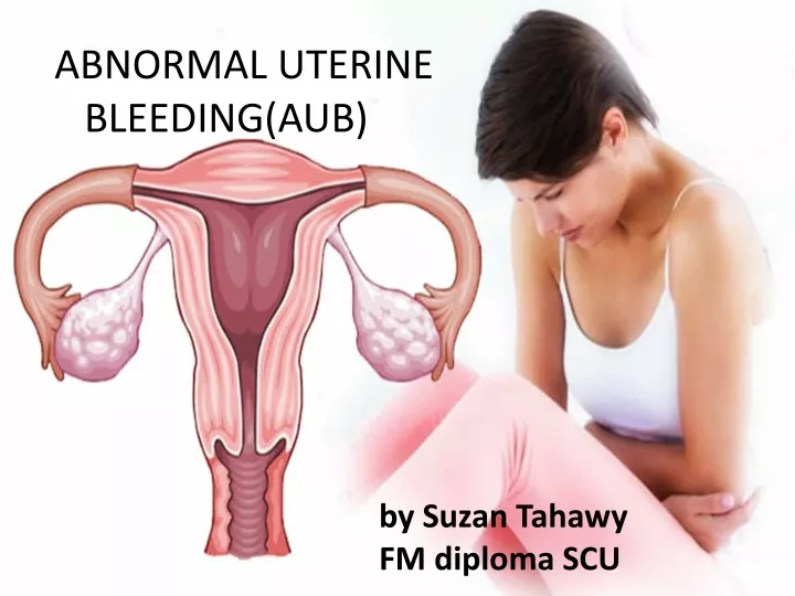abnormal uterine bleeding aub