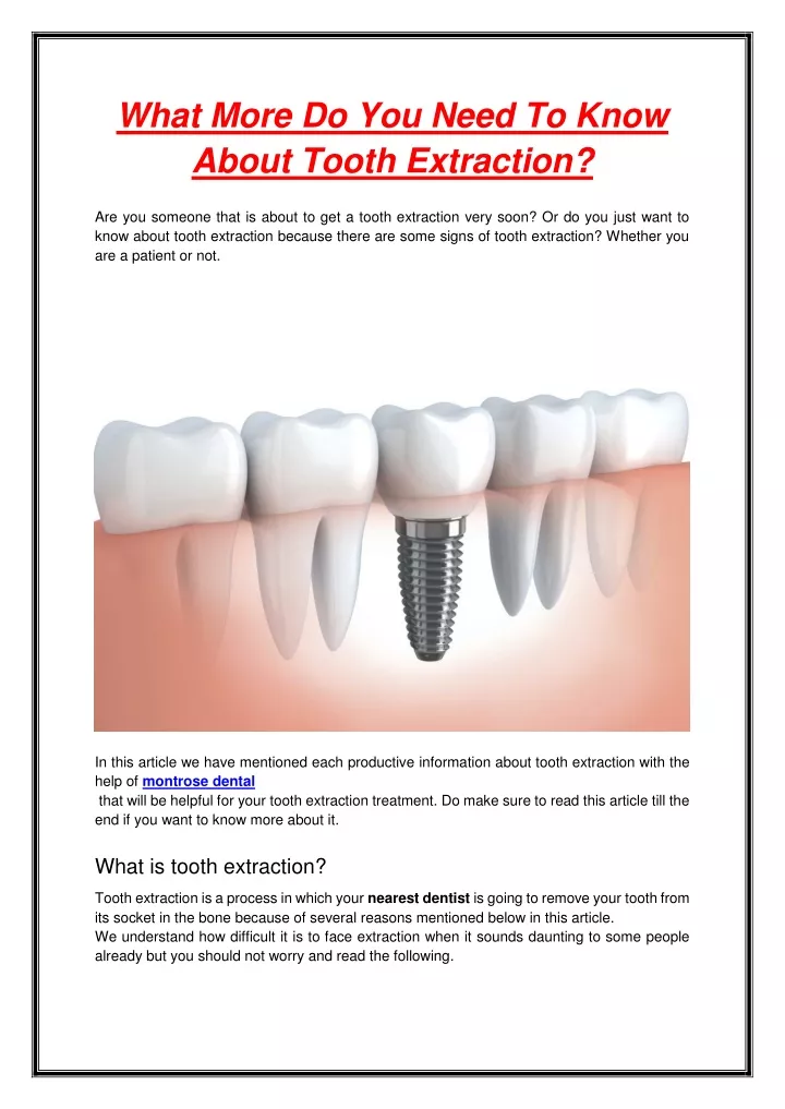 what more do you need to know about tooth