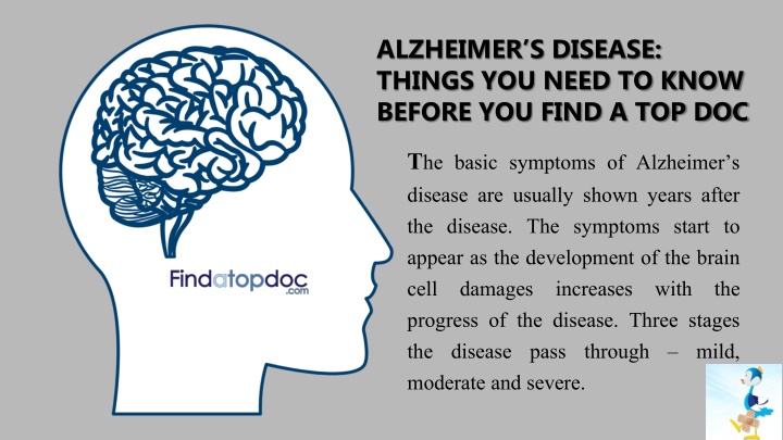 alzheimer s disease things you need to know