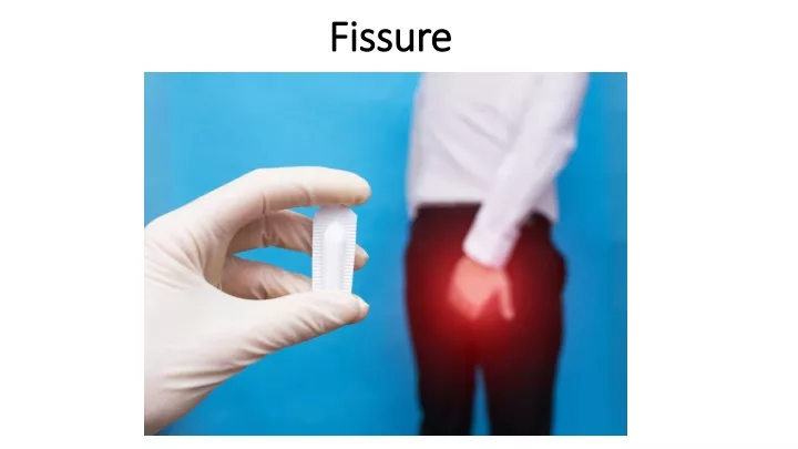 fissure