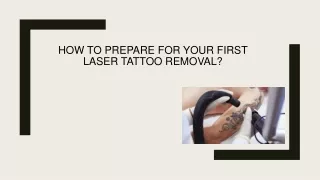How To Prepare For Your First Laser Tattoo Removal