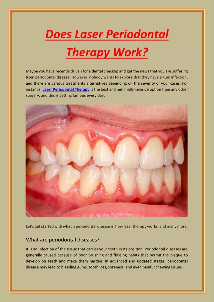 does laser periodontal therapy work