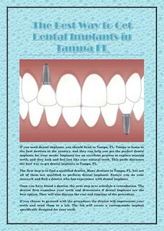 The Best Way to Get Dental Implants in Tampa FL