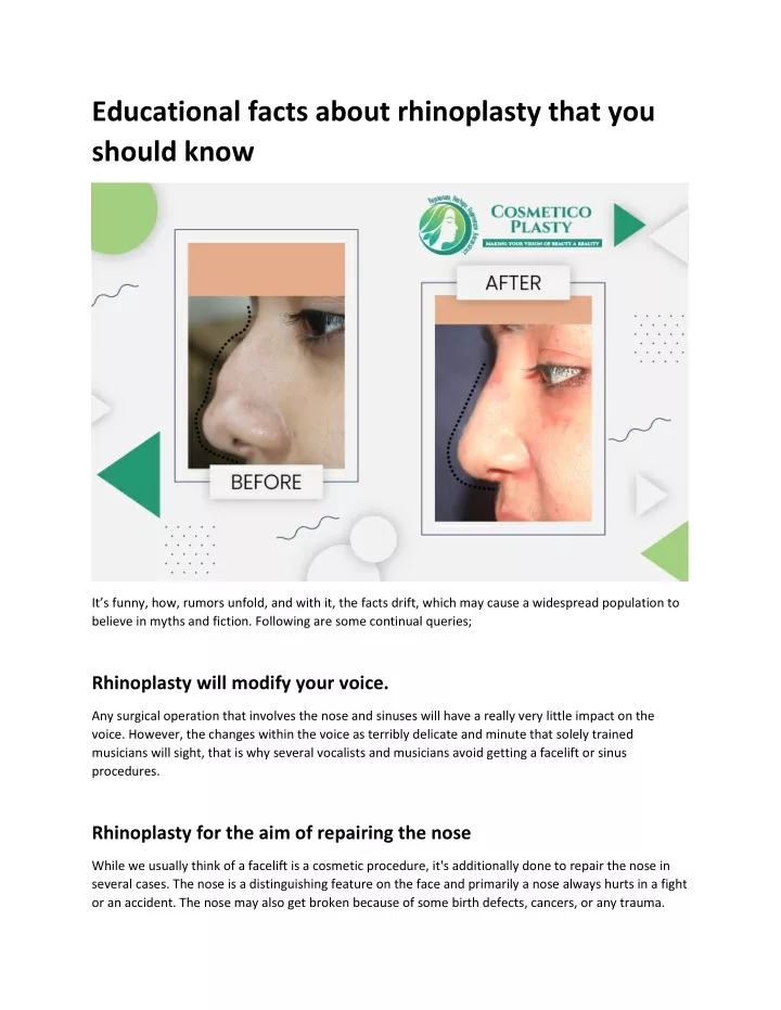 educational facts about rhinoplasty that