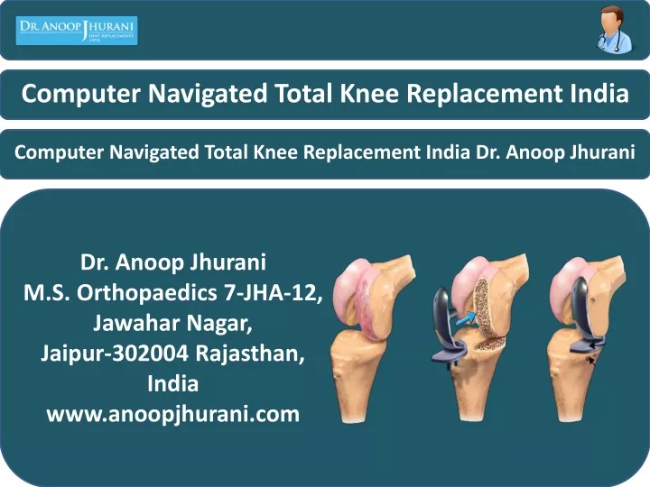 computer navigated total knee replacement india