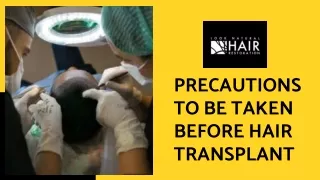 Precautions To Be Taken Before Hair Transplant