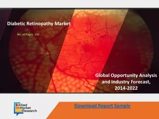 Diabetic Retinopathy Market Growth Prospects to 2030 | AMR