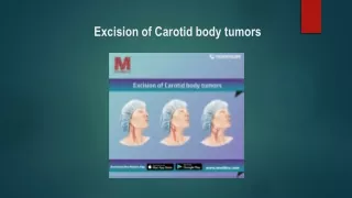 excision of carotid body tumors
