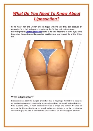 what do you need to know about liposuction
