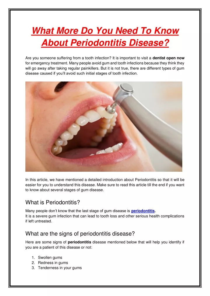 what more do you need to know about periodontitis